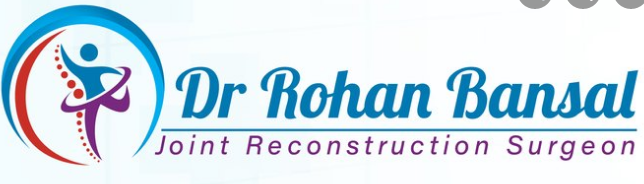 Jointsreconstruction
